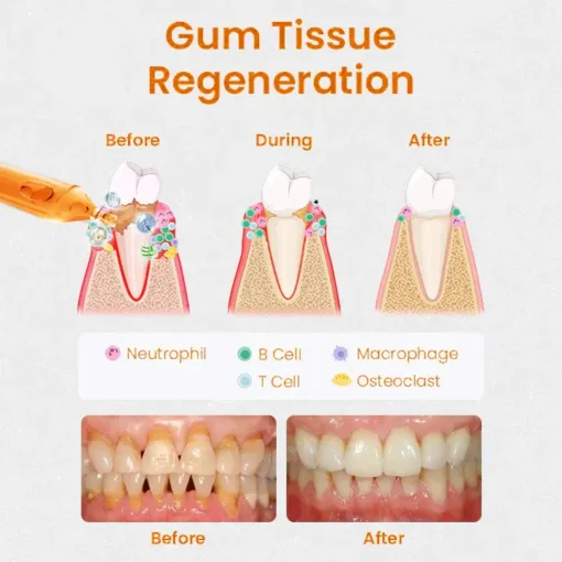 LOVILDS™ Gum Repair Treatment Ampoules