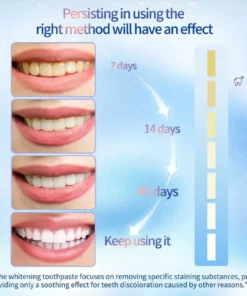 LOVILDS™ Niacinamide Whitening Toothpaste