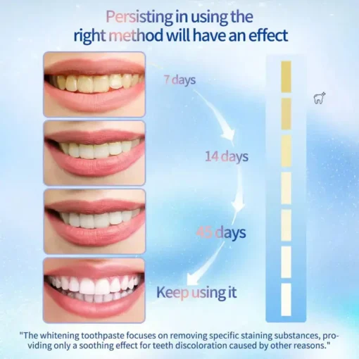 LOVILDS™ Niacinamide Whitening Toothpaste