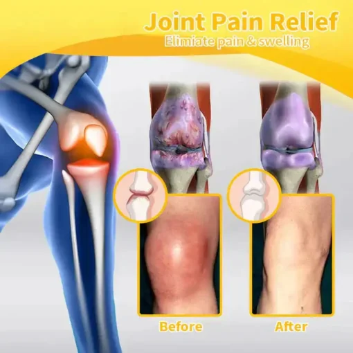 LOVILDS™ Bee toxin Joint Care Spray