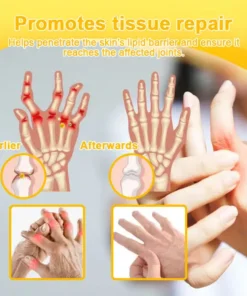 LOVILDS™ Botulinum Toxin & Bee Venom Pain-Relief Bone Healing Cream