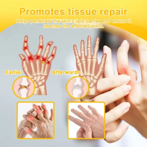 LOVILDS™ Botulinum Toxin & Bee Venom Pain-Relief Bone Healing Cream