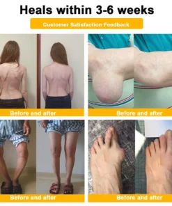 LOVILDS™ Botulinum Toxin & Bee Venom Pain-Relief Bone Healing Cream