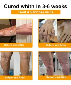 LOVILDS™ Botulinum Toxin & Bee Venom Pain-Relief Bone Healing Cream