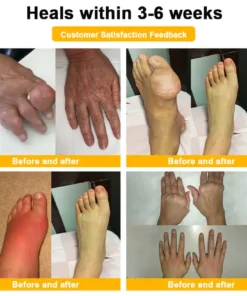 LOVILDS™ Botulinum Toxin & Bee Venom Pain-Relief Bone Healing Cream