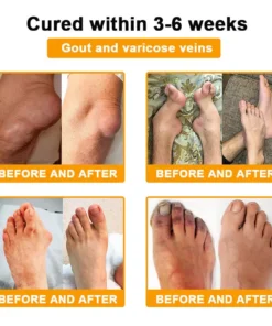 LOVILDS™ Botulinum Toxin & Bee Venom Pain-Relief Bone Healing Cream