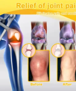 LOVILDS™ Botulinum Toxin & Bee Venom Pain-Relief Bone Healing Cream