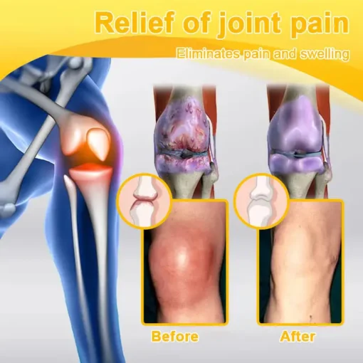 LOVILDS™ Botulinum Toxin & Bee Venom Pain-Relief Bone Healing Cream