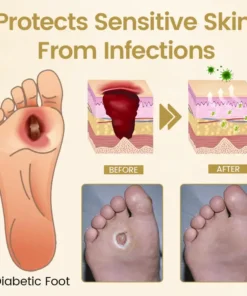LOVILDS™ Diabetic Foot Healing Spray