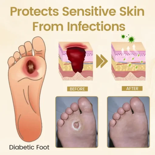 LOVILDS™ Diabetic Foot Healing Spray