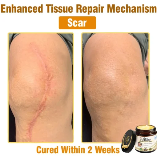 LOVILDS® Full-Body Repair Cream