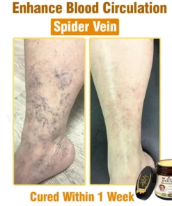 LOVILDS® Full-Body Repair Cream