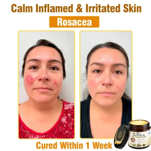 LOVILDS® Full-Body Repair Cream