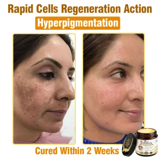 LOVILDS® Full-Body Repair Cream