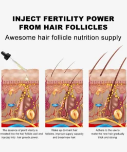 LOVILDS™ Hair Growth Essence