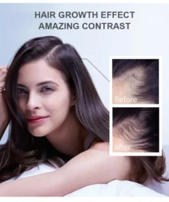 LOVILDS™ Hair Growth Essence