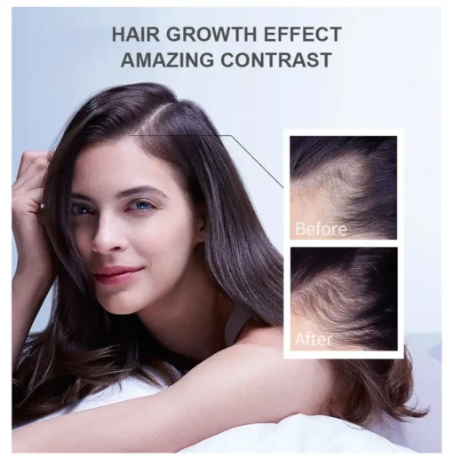 LOVILDS™ Hair Growth Essence