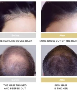 LOVILDS™ Hair Growth Essence