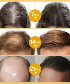 LOVILDS™ Hair Growth Essence