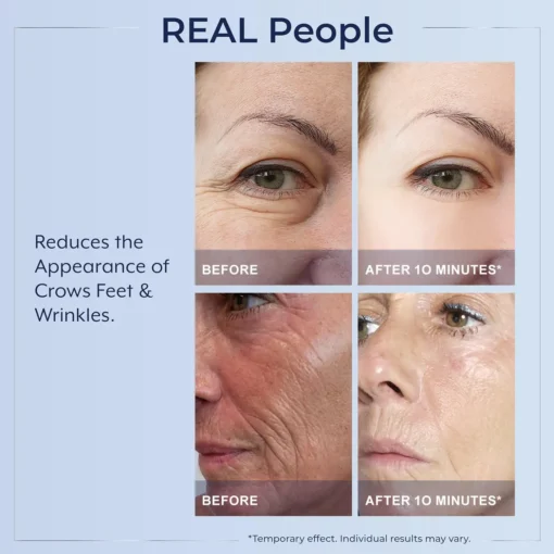LOVILDS™ Instant Wrinkle Eye Tightener cream