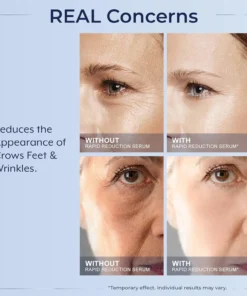 LOVILDS™ Instant Wrinkle Eye Tightener cream