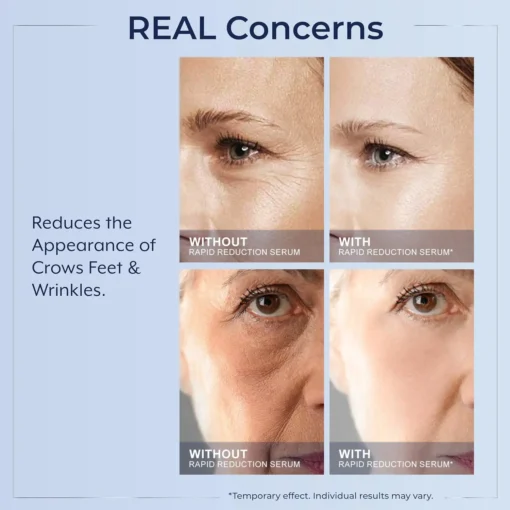 LOVILDS™ Instant Wrinkle Eye Tightener cream