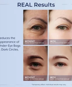 LOVILDS™ Instant Wrinkle Eye Tightener cream