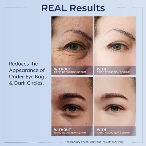 LOVILDS™ Instant Wrinkle Eye Tightener cream