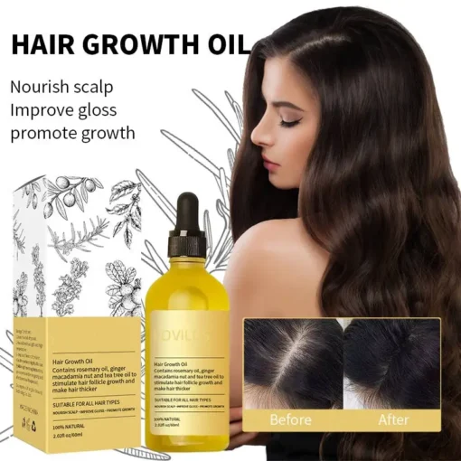 LOVILDS™ Rosemary Hair Growth Essence 100% Natural Hair Growth