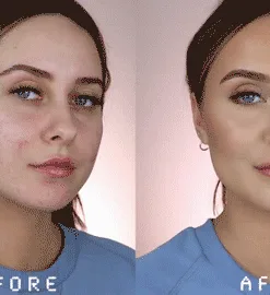 LOVILDS™ Wrinkle Cream