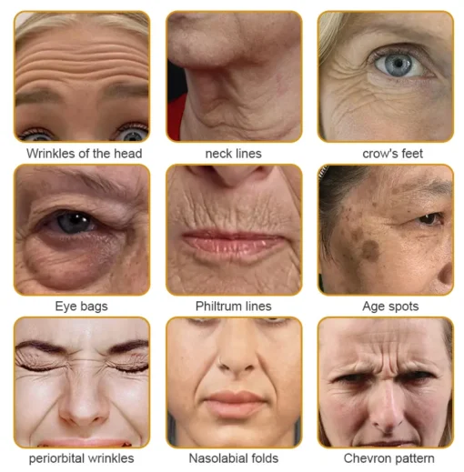 LOVILDS™ Wrinkle Cream