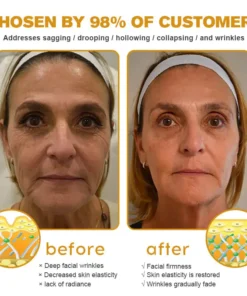LOVILDS™ Wrinkle Cream
