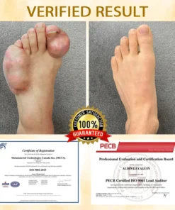 Lovilds™ BeeEase MicroSting Joint Patches