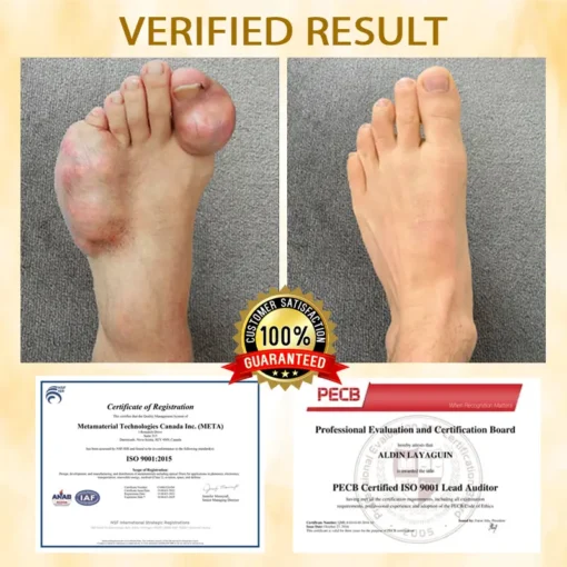 Lovilds™ BeeEase MicroSting Joint Patches