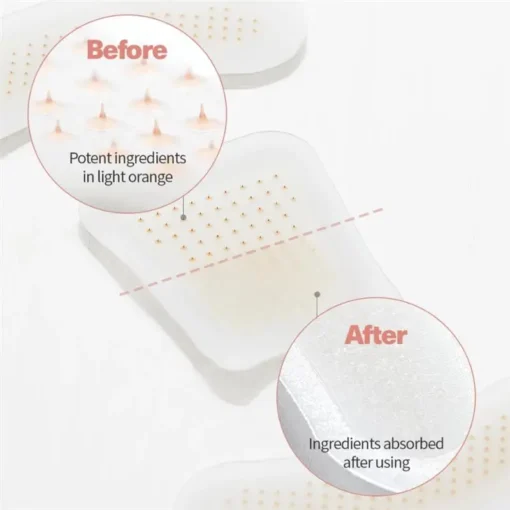 Lovilds™ BeeEase MicroSting Joint Patches