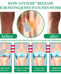 Lovilds™ BeeEase MicroSting Joint Patches