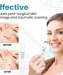 Lovilds® Medical-Grade Laser Scar Pen