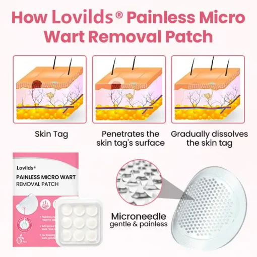 Lovilds® Painless Micro Wart Removal Patch