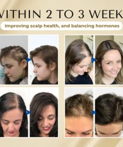 Lovilds® VitaStrand Biotin Hair Growth Spray