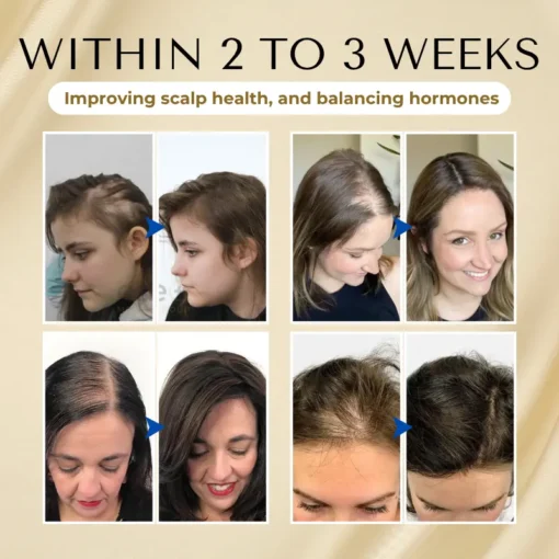 Lovilds® VitaStrand Biotin Hair Growth Spray