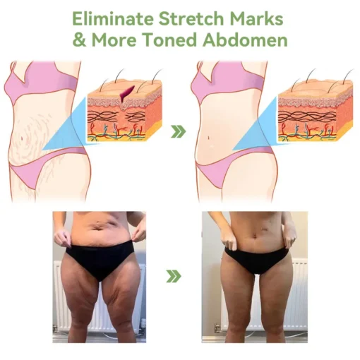 LOVILDS™𝐋𝐮𝐱𝐮𝐫𝐢𝐨𝐮𝐬 𝐂𝐨𝐥𝐥𝐚𝐠𝐞𝐧 𝐅𝐢𝐫𝐦𝐢𝐧𝐠 𝐂𝐫𝐞𝐚𝐦