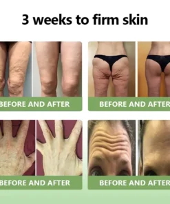 LOVILDS™𝐋𝐮𝐱𝐮𝐫𝐢𝐨𝐮𝐬 𝐂𝐨𝐥𝐥𝐚𝐠𝐞𝐧 𝐅𝐢𝐫𝐦𝐢𝐧𝐠 𝐂𝐫𝐞𝐚𝐦