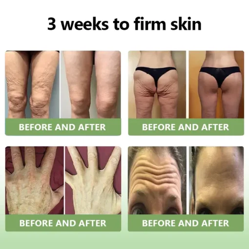 LOVILDS™𝐋𝐮𝐱𝐮𝐫𝐢𝐨𝐮𝐬 𝐂𝐨𝐥𝐥𝐚𝐠𝐞𝐧 𝐅𝐢𝐫𝐦𝐢𝐧𝐠 𝐂𝐫𝐞𝐚𝐦