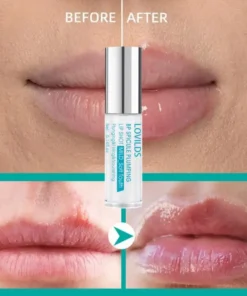 LOVILDS™ BP Spicule Plumping Lip Shot