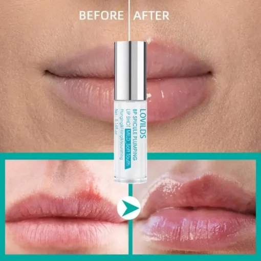 LOVILDS™ BP Spicule Plumping Lip Shot