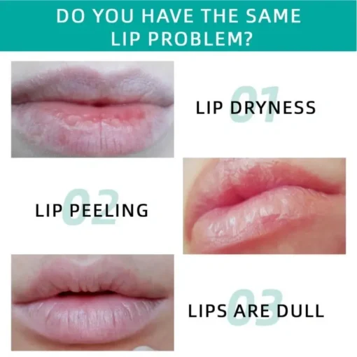 LOVILDS™ BP Spicule Plumping Lip Shot