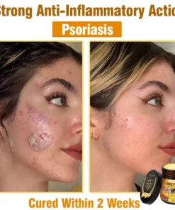 LOVILDS™ Bee Poison All-in-One Cream