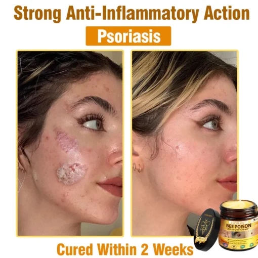 LOVILDS™ Bee Poison All-in-One Cream