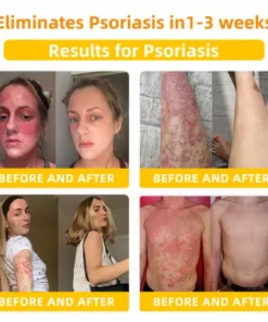 LOVILDS™ Bee Toxin Skin Repair Cream