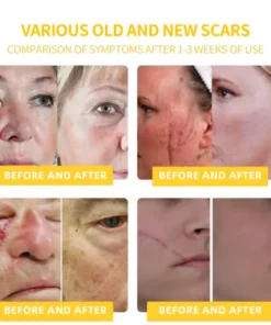 LOVILDS™ Bee Toxin Skin Repair Cream